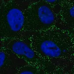 Merck Anti-AP2B1 antibody produced in rabbit
