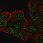 Merck Anti-RCBTB1 antibody produced in rabbit