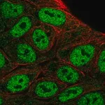 Merck Anti-HOXD1 antibody produced in rabbit