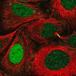 Merck Anti-XPA antibody produced in rabbit
