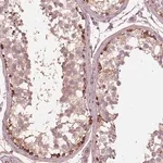 Merck Anti-STK33 antibody produced in rabbit