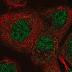 Merck Anti-DYRK2 antibody produced in rabbit