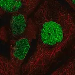 Merck Anti-SUMO1 antibody produced in rabbit