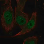 Merck Anti-EVI2A antibody produced in rabbit