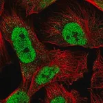 Merck Anti-RAD23A antibody produced in rabbit