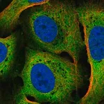 Merck Anti-CACYBP antibody produced in rabbit