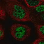 Merck Anti-PALB2 antibody produced in rabbit