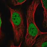 Merck Anti-TFAP2C antibody produced in rabbit