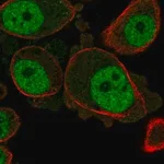 Merck Anti-KCNN3 antibody produced in rabbit