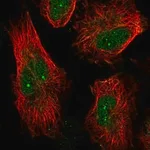 Merck Anti-NUAK1 antibody produced in rabbit
