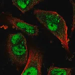 Merck Anti-KDM3B antibody produced in rabbit