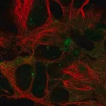 Merck Anti-DYNC1LI2 antibody produced in rabbit