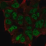 Merck Anti-ZNF460 antibody produced in rabbit