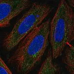 Merck Anti-TTPAL antibody produced in rabbit