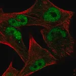 Merck Anti-MYC antibody produced in rabbit