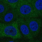 Merck Anti-PABPC1L antibody produced in rabbit