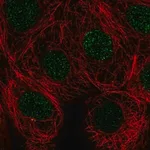 Merck Anti-SIVA1 antibody produced in rabbit