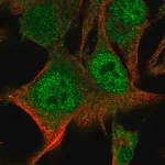 Merck Anti-PARP9 antibody produced in rabbit