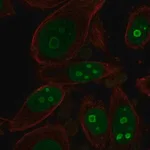 Merck Anti-BOP1 antibody produced in rabbit