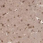 Merck Anti-TARSL2 antibody produced in rabbit