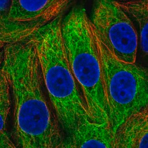 Merck Anti-EPPK1 antibody produced in rabbit