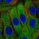 Merck Anti-EPPK1 antibody produced in rabbit