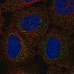 Merck Anti-RP11-80H18.3 antibody produced in rabbit