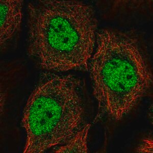 Merck Anti-BNC1 antibody produced in rabbit