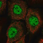 Merck Anti-BNC1 antibody produced in rabbit