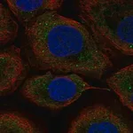 Merck Anti-UPF2 antibody produced in rabbit