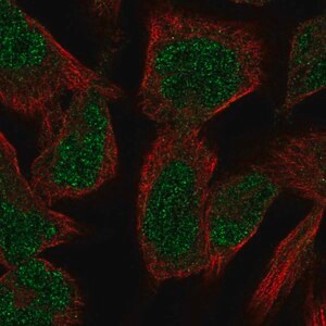 Merck Anti-PKNOX2 antibody produced in rabbit