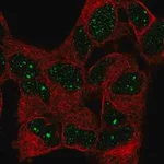Merck Anti-BAZ1B antibody produced in rabbit