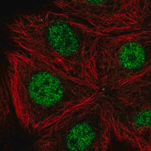 Merck Anti-CDK10 antibody produced in rabbit