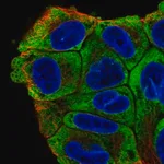 Merck Anti-PABPC1 antibody produced in rabbit
