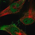 Merck Anti-MYSM1 antibody produced in rabbit