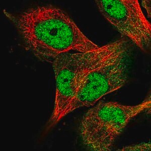 Merck Anti-USP24 antibody produced in rabbit