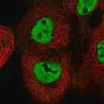 Merck Anti-ESRP2 antibody produced in rabbit