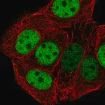 Merck Anti-CHTF18 antibody produced in rabbit