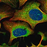 Merck Anti-RTN1 antibody produced in rabbit