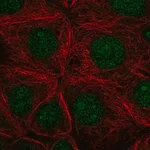 Merck Anti-SF3B3 antibody produced in rabbit