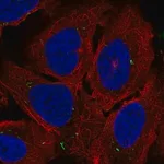 Merck Anti-ADCY7 antibody produced in rabbit