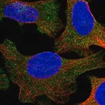 Merck Anti-UBAP1 antibody produced in rabbit