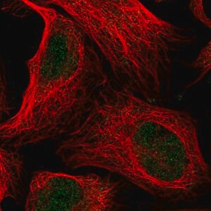 Merck Anti-ANKRD11 antibody produced in rabbit