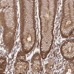 Merck Anti-ZFYVE19 antibody produced in rabbit