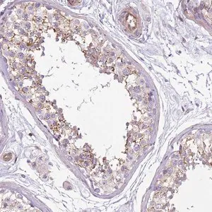 Merck Anti-GNAI1 antibody produced in rabbit