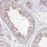 Merck Anti-GNAI1 antibody produced in rabbit