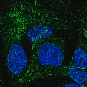 Merck Anti-SPRY2 antibody produced in rabbit