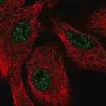 Merck Anti-SETX antibody produced in rabbit