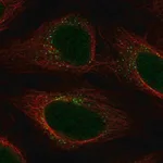 Merck Anti-YIPF5 antibody produced in rabbit