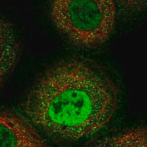 Merck Anti-ERAP1 antibody produced in rabbit